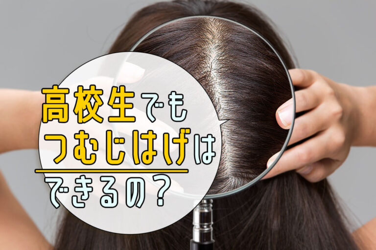 高校生のつむじはげって基準は何？今から始める対策方法も紹介